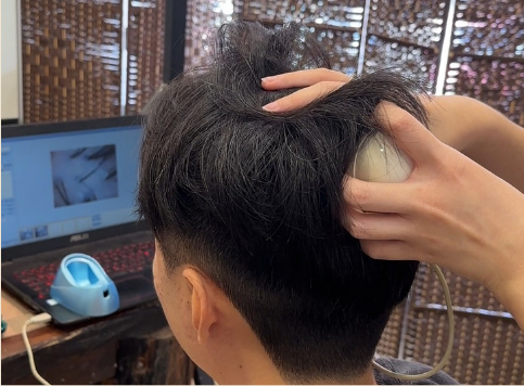 Sky · Scalp care · 25